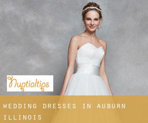 Wedding Dresses in Auburn (Illinois)
